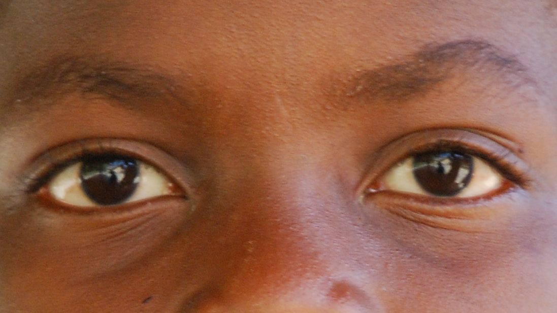 « Le déblayeur de cadavre »