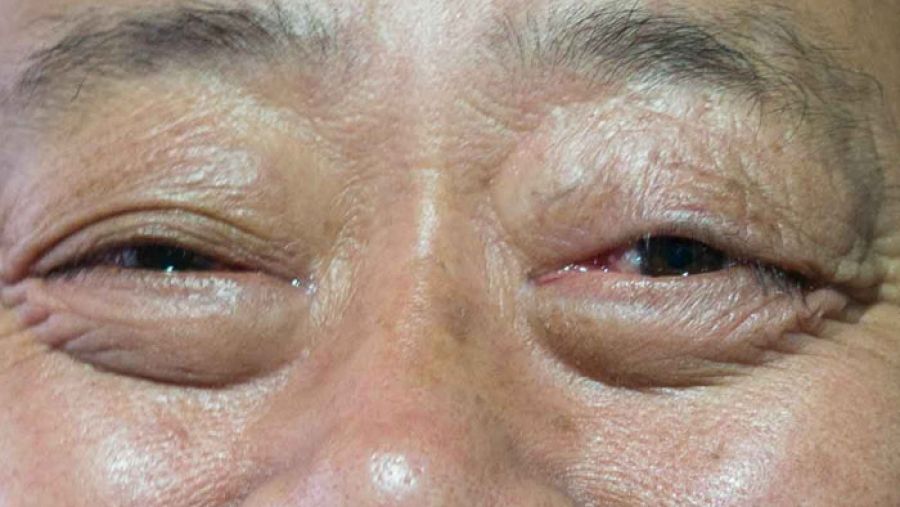 All of us migrants; what about me?